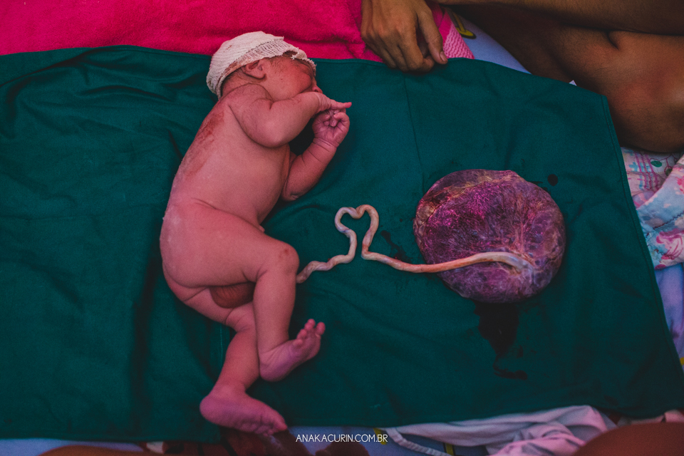 Parto natural do Bento que aconteceu na Casa de Parto David Capistrano em Realengo, Rio de Janeiro, fotografado por Ana Kacurin