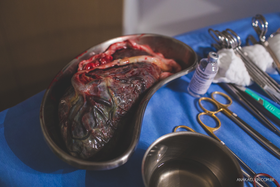 Parto natural hospitalar de Tomás, fotografado por Ana Kacurin na Perinatal de Laranjeiras, no Rio de Janeiro