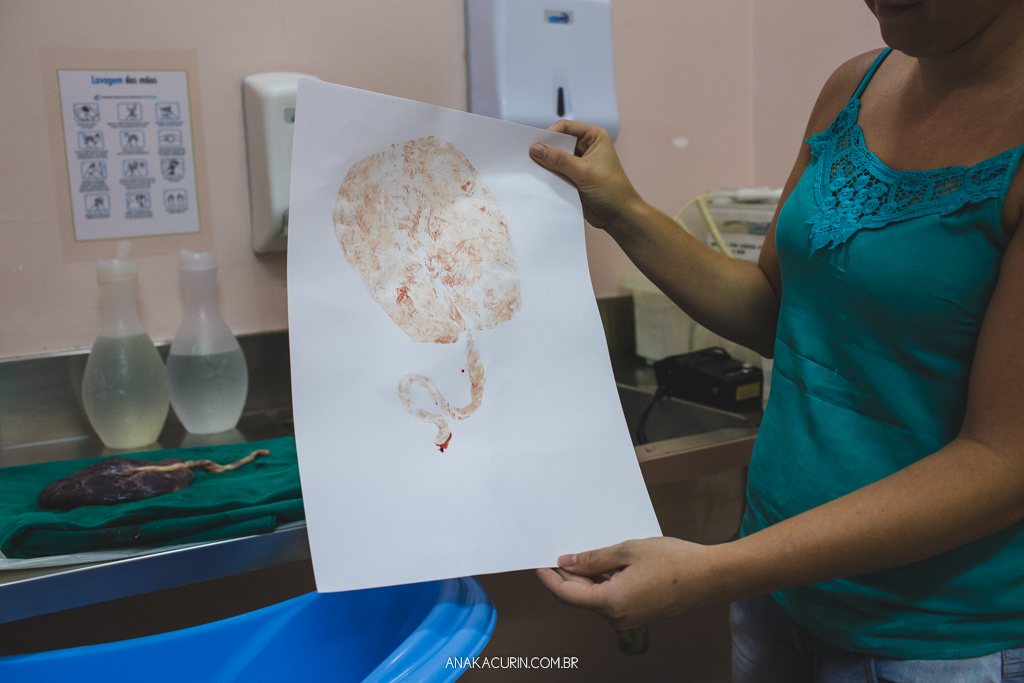 Parto normal humanizado de Maria Julia, filha de Vitor Paravidino e Tatiana Henriques, que aconteceu na Casa de Parto Davi Capistrano em Realengo, Rio de Janeiro, a famosa Casinha, fotografado por Ana Kacurin.