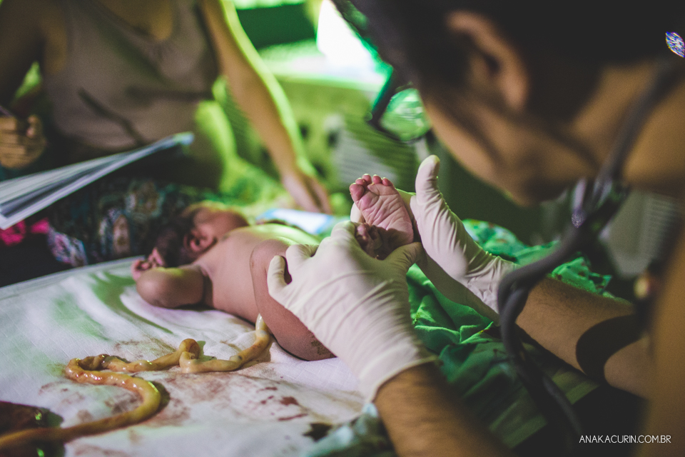 bebê recém nascido ainda conectado À pacenta através do cordão umbilical, sendo examinado pela parteira