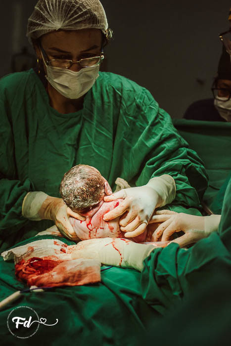 franciele duailibi photography; 
fotografia de gestante cg
fotografia de parto; campo grande;
fotografia;
recem nascido; maternidade candido mariano; fotografa de criança;
fotos de nascimento;
franciele duailibi;
fotografo de parto cg