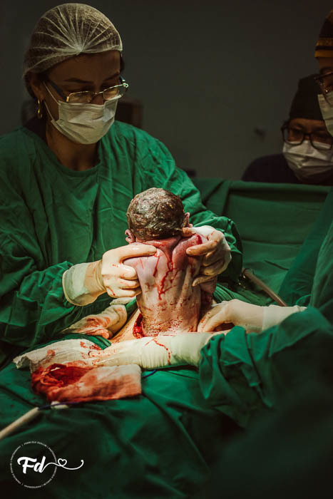 franciele duailibi photography; 
fotografia de gestante cg
fotografia de parto; campo grande;
fotografia;
recem nascido; maternidade candido mariano; fotografa de criança;
fotos de nascimento;
franciele duailibi;
fotografo de parto cg