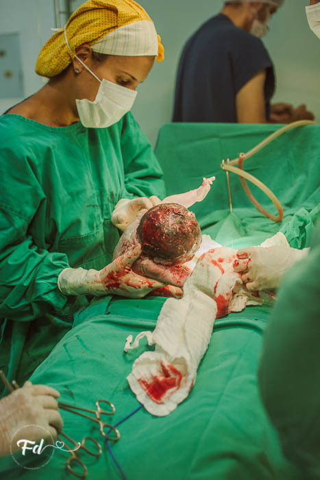 franciele duailibi photography; 
fotografia de gestante cg
fotografia de parto; campo grande;
fotografia;
recem nascido; maternidade candido mariano; fotografa de criança;
fotos de nascimento;
franciele duailibi;
fotografo de parto cg