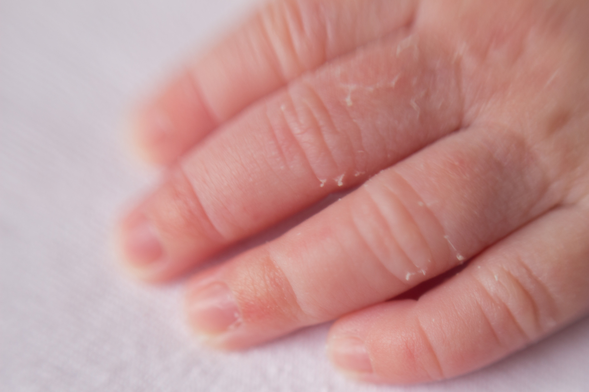 Foto de detalhe da mão em ensaio newborn 