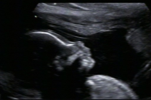 Imagem capa - Orientações para ensaio Algodão Doce (recém-nascido) por Chaiane A. Mariano