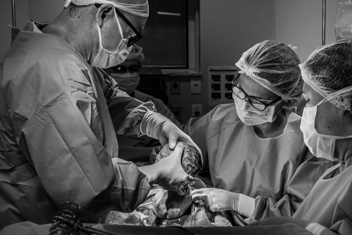Fotografia do parto do Gustavo realizado na maternidade Perinatal da Barra da Tijuca. Imagens da fotógrafa de casamento e famílias Jaque Salles 