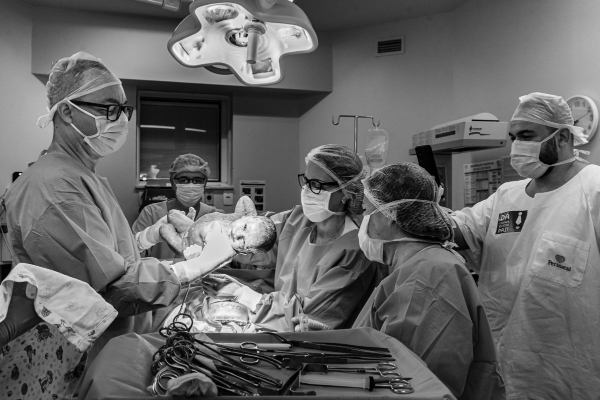 Fotografia do parto do Gustavo A fotógrafa de parto carioca Jaque Salles registra o momento que o bebê nasce e já de olhos abertos encara a câmera fotográfica. O registro aconteceu na maternidade perinatal da Barra da Tijuca em maio de 2021.