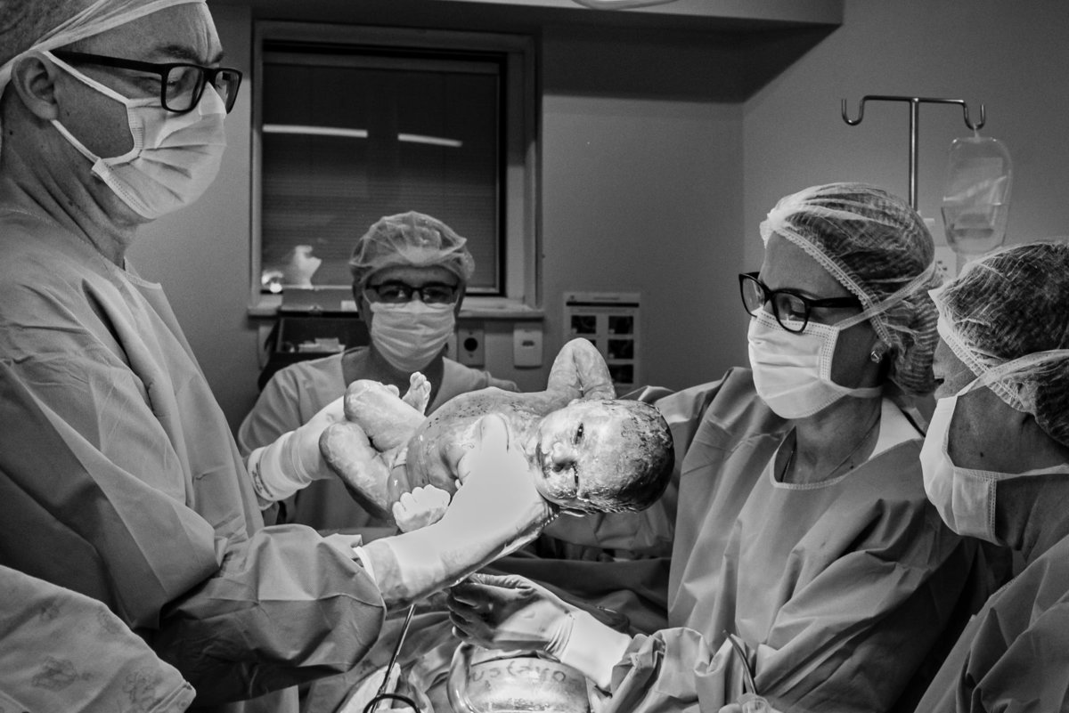 A fotógrafa de parto carioca Jaque Salles registra o momento que o bebê nasce e já de olhos abertos encara a câmera fotográfica. O registro aconteceu na maternidade perinatal da Barra da Tijuca em maio de 2021.