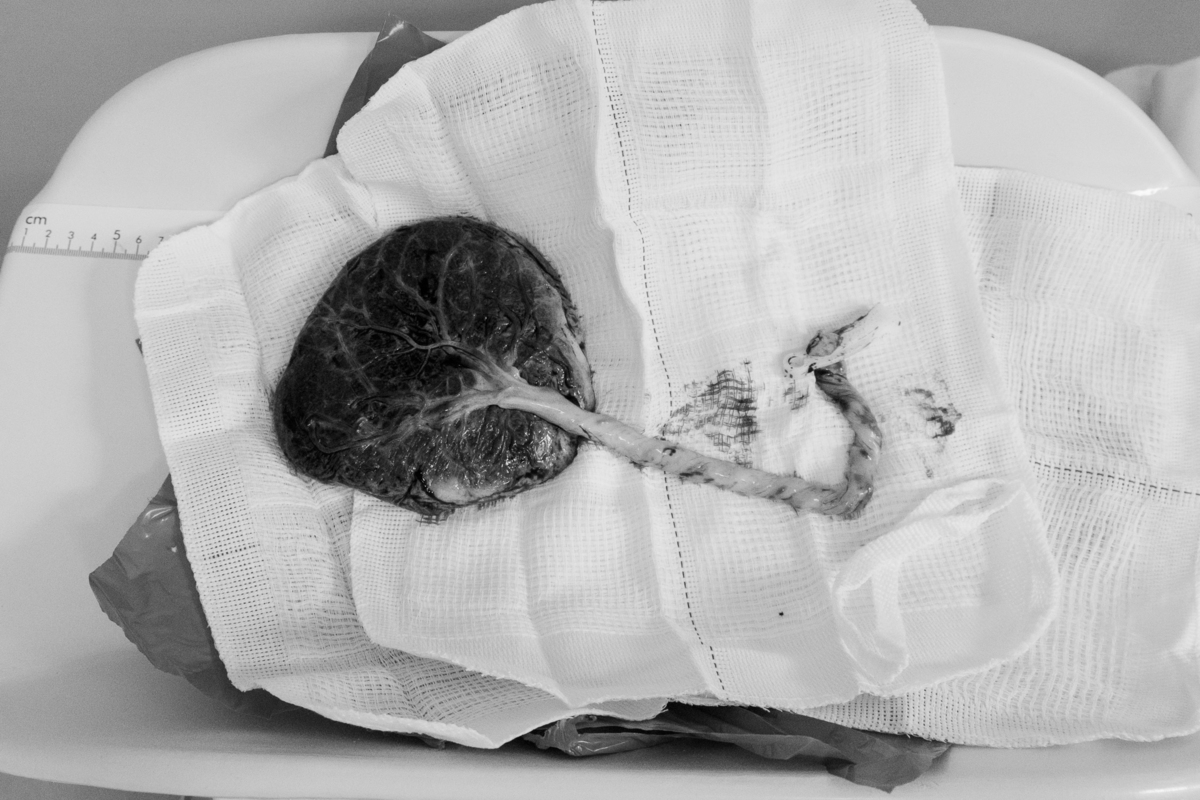 fotografia-nascimento