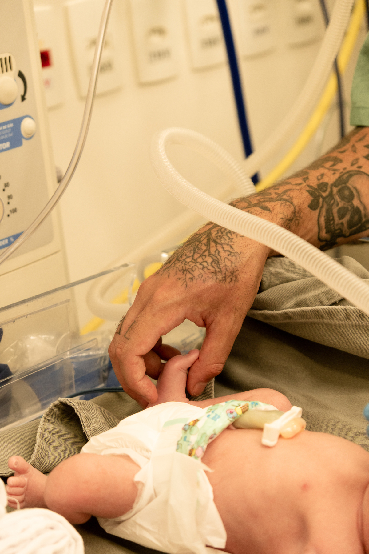 fotografia-parto-cesariana