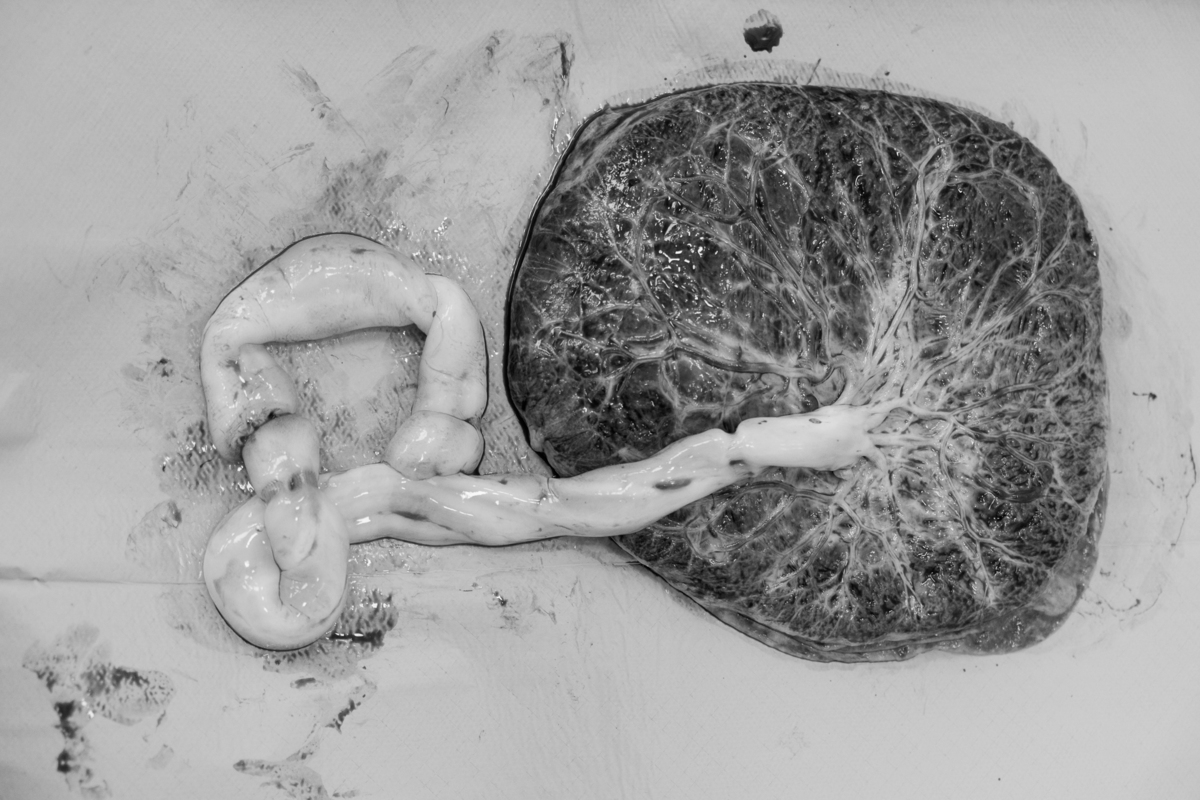 registro-de-parto-sp