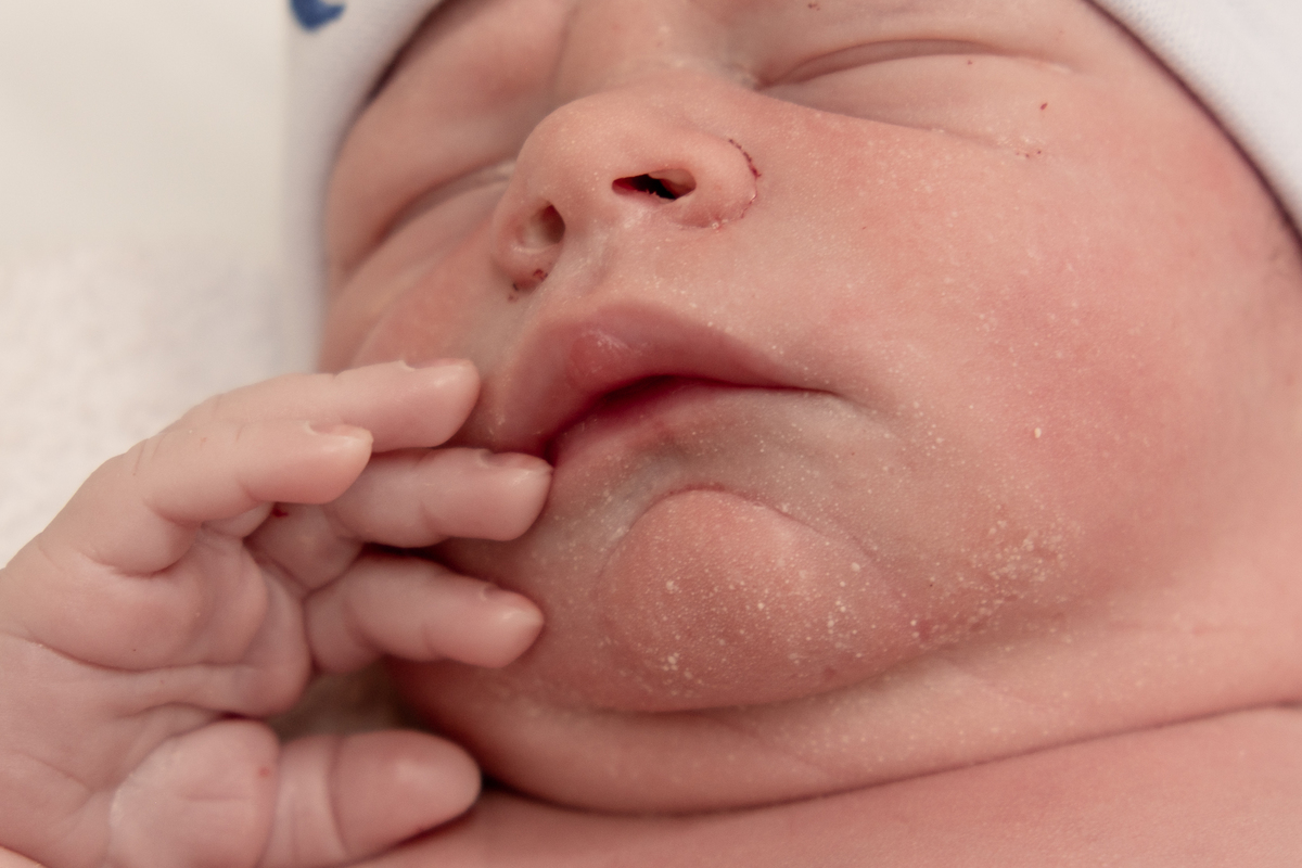 fotografia-nascimento-cesariana-sp