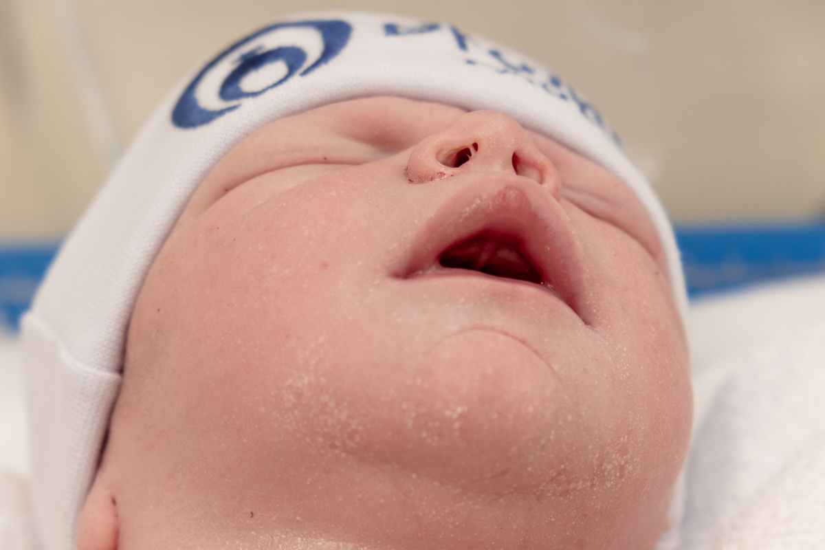 foto-parto-cesariana-sp