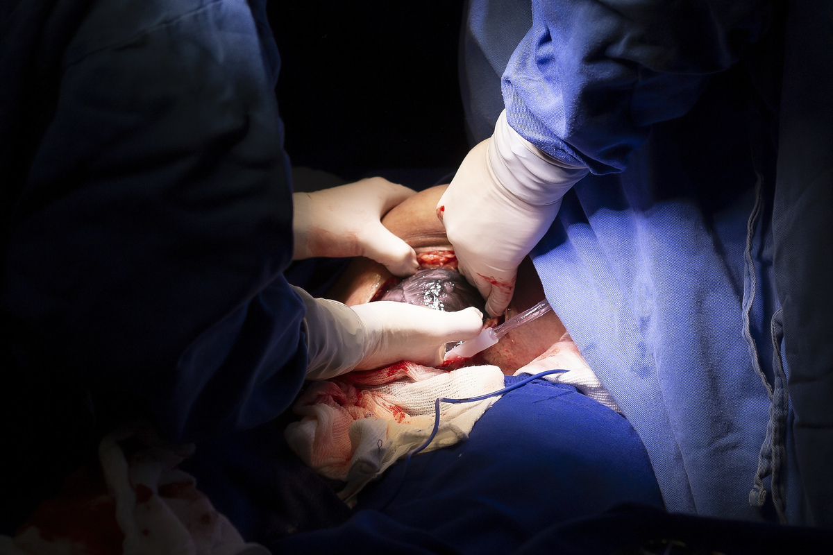 Nascimento, parto, cesariana, hospital, neném, semanas.