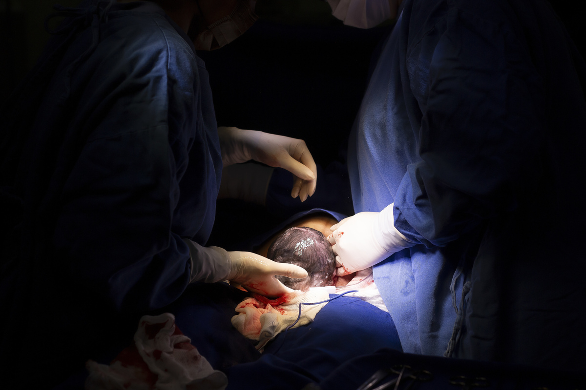 Nascimento, parto, cesariana, hospital, neném, semanas.