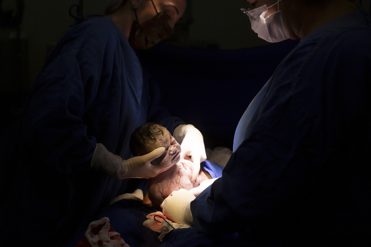 Nascimento, parto, cesariana, hospital, neném, semanas.