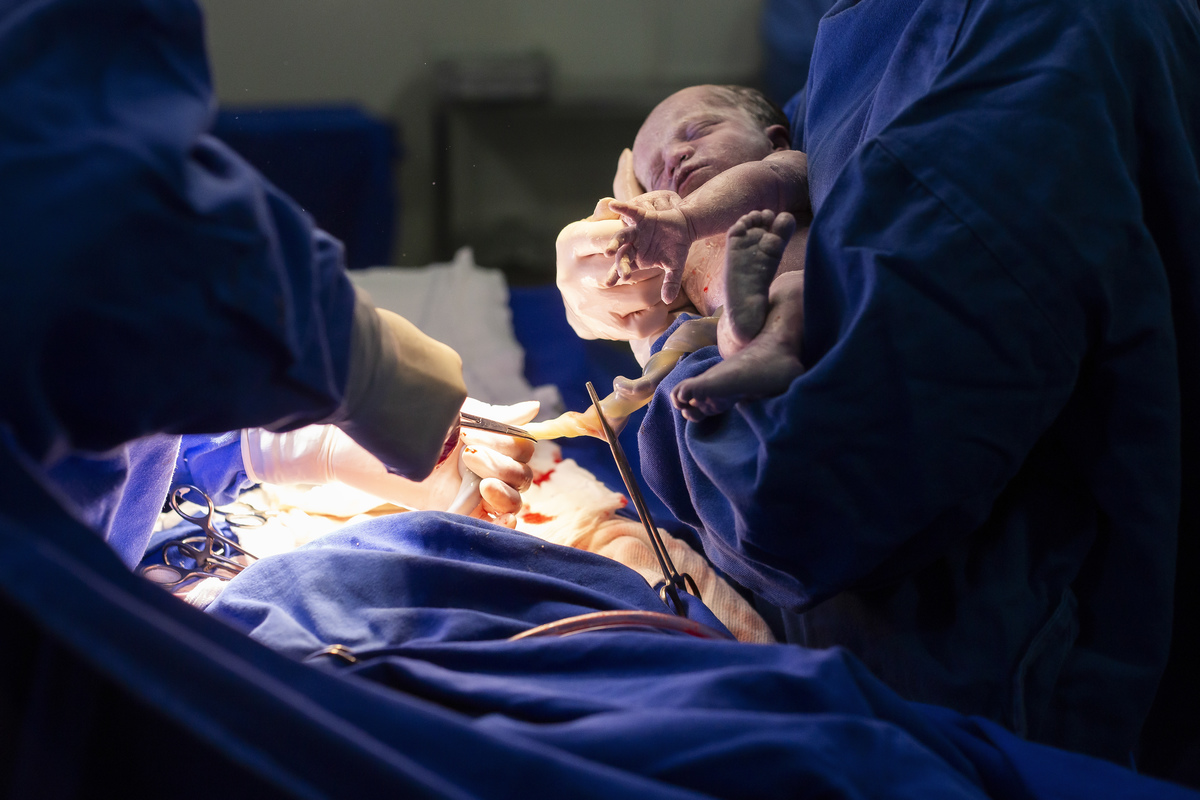 Nascimento, parto, cesariana, hospital, neném, semanas.