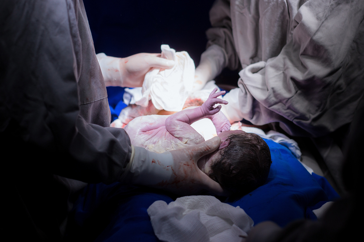 Nascimento, parto, cesariana, hospital, neném, semanas.