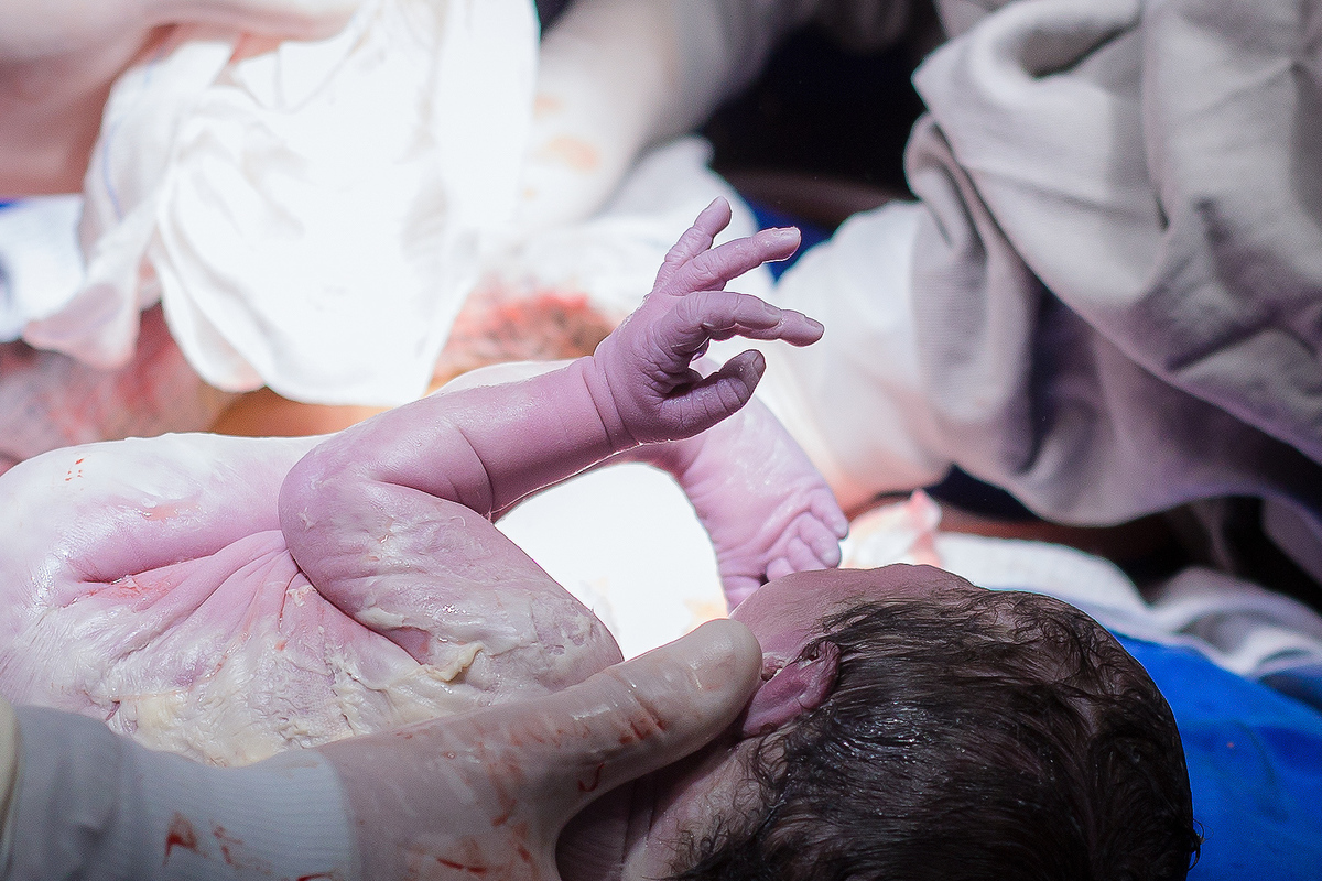 Nascimento, parto, cesariana, hospital, neném, semanas.