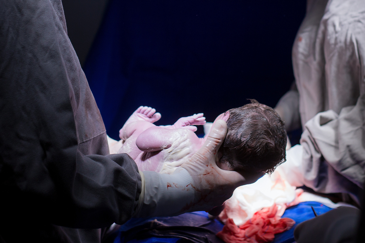 Nascimento, parto, cesariana, hospital, neném, semanas.