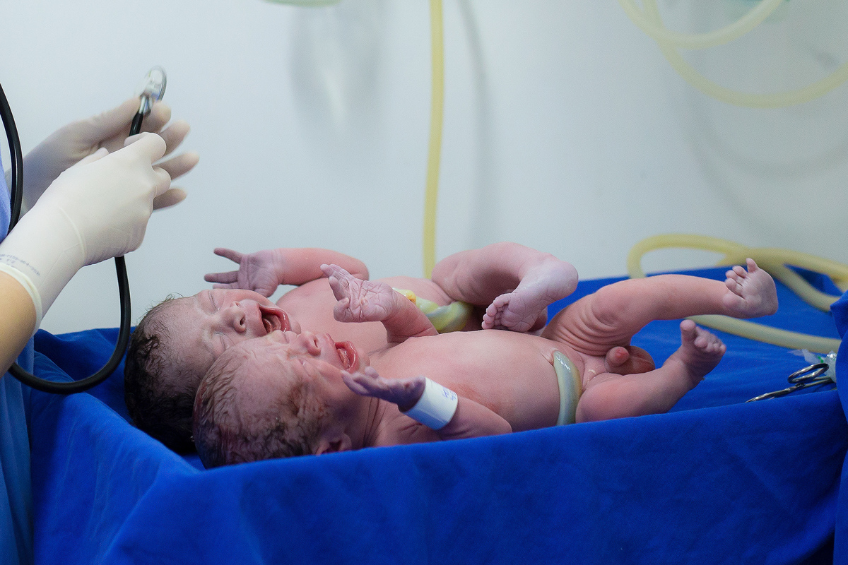 Nascimento, parto, cesariana, hospital, neném, semanas.