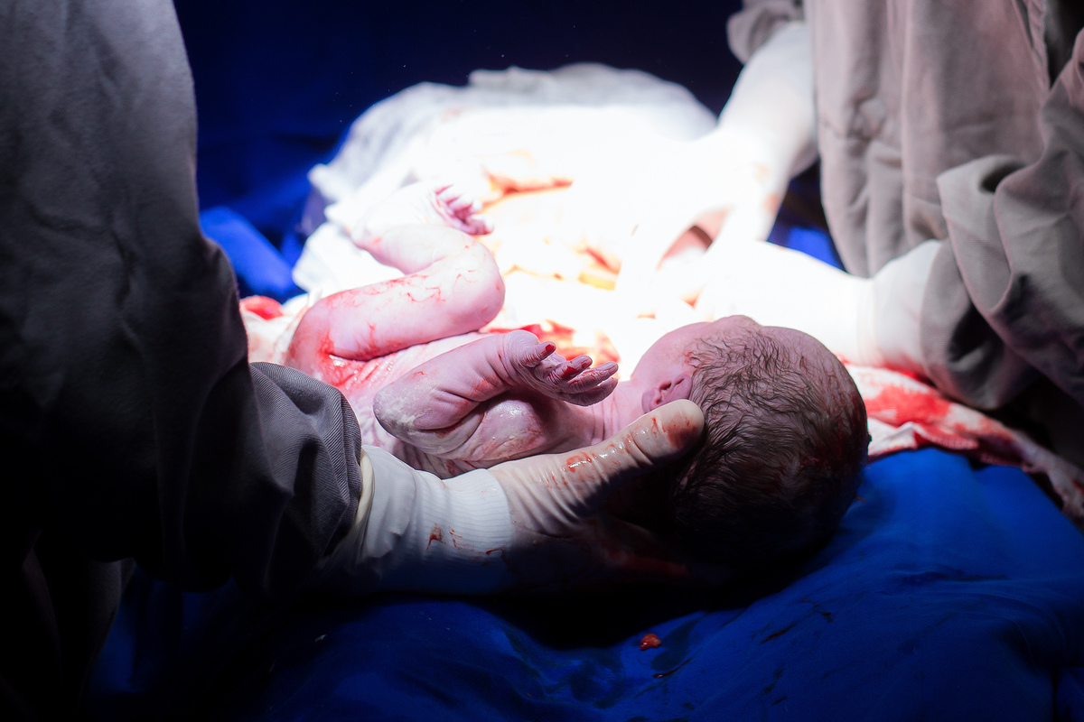 Nascimento, parto, cesariana, hospital, neném, semanas.