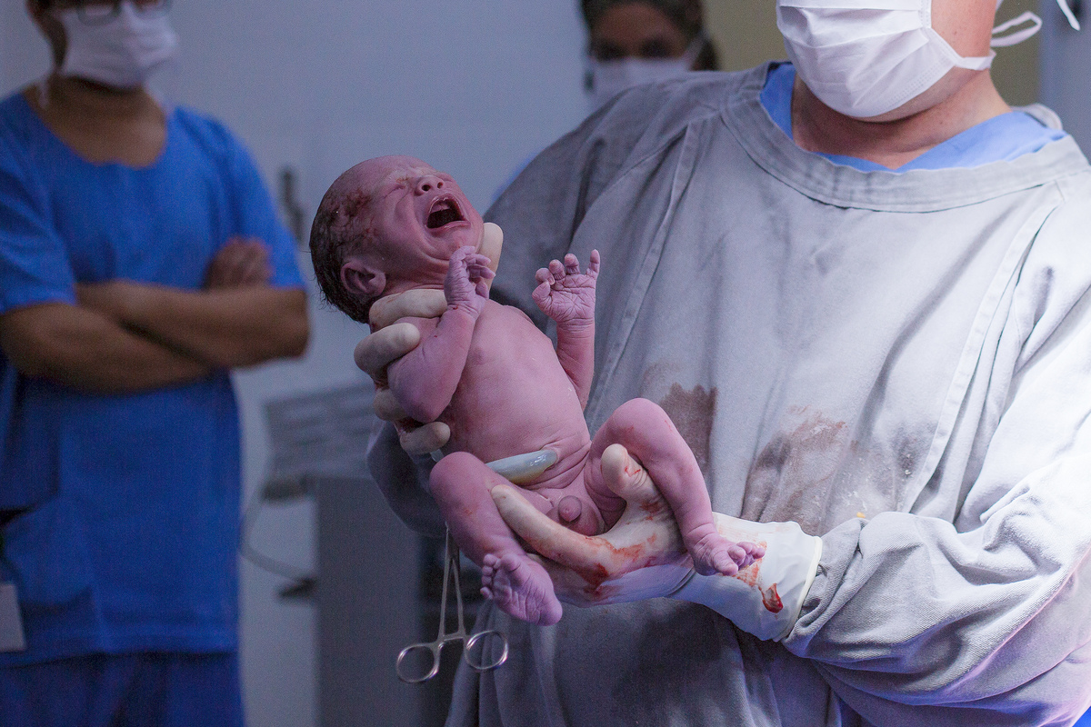 Nascimento, parto, cesariana, hospital, neném, semanas.