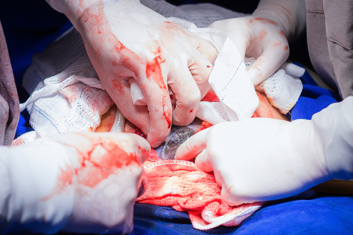 Nascimento, parto, cesariana, hospital, neném, semanas.