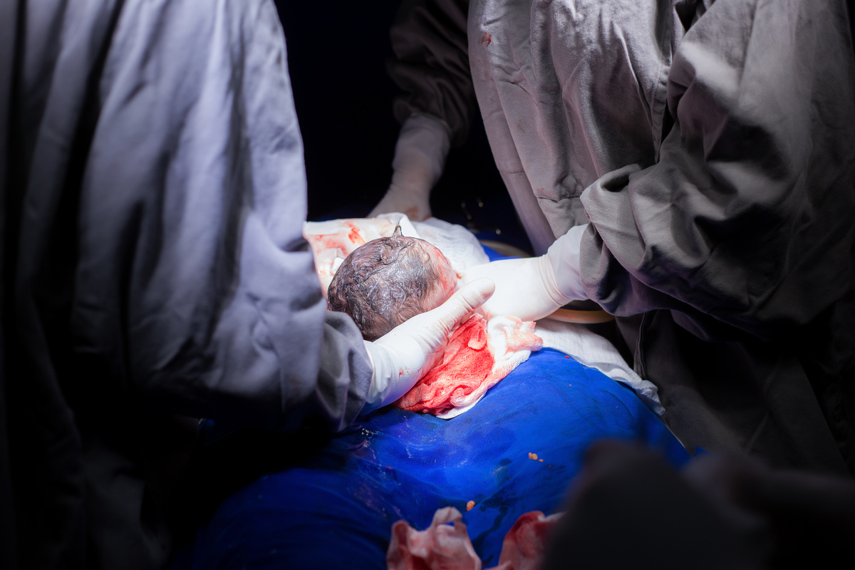 Nascimento, parto, cesariana, hospital, neném, semanas.