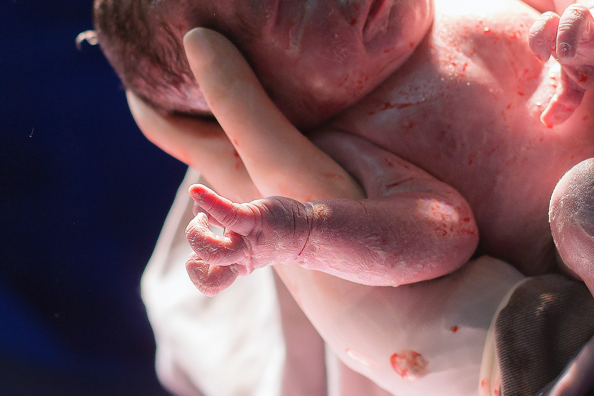 Nascimento, parto, cesariana, hospital, neném, semanas.