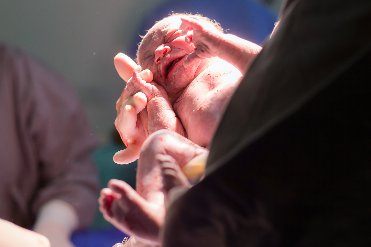 Nascimento, parto, cesariana, hospital, neném, semanas.