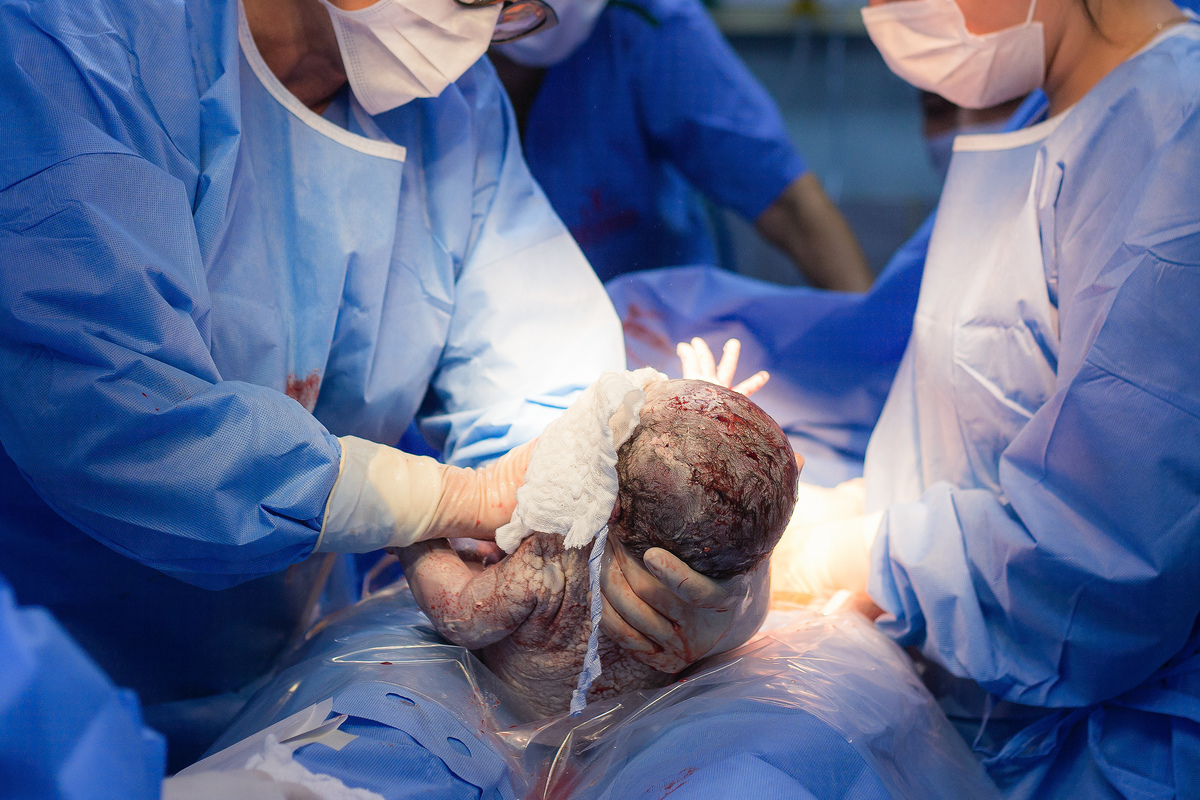 Nascimento, parto, cesariana, hospital, neném, semanas.