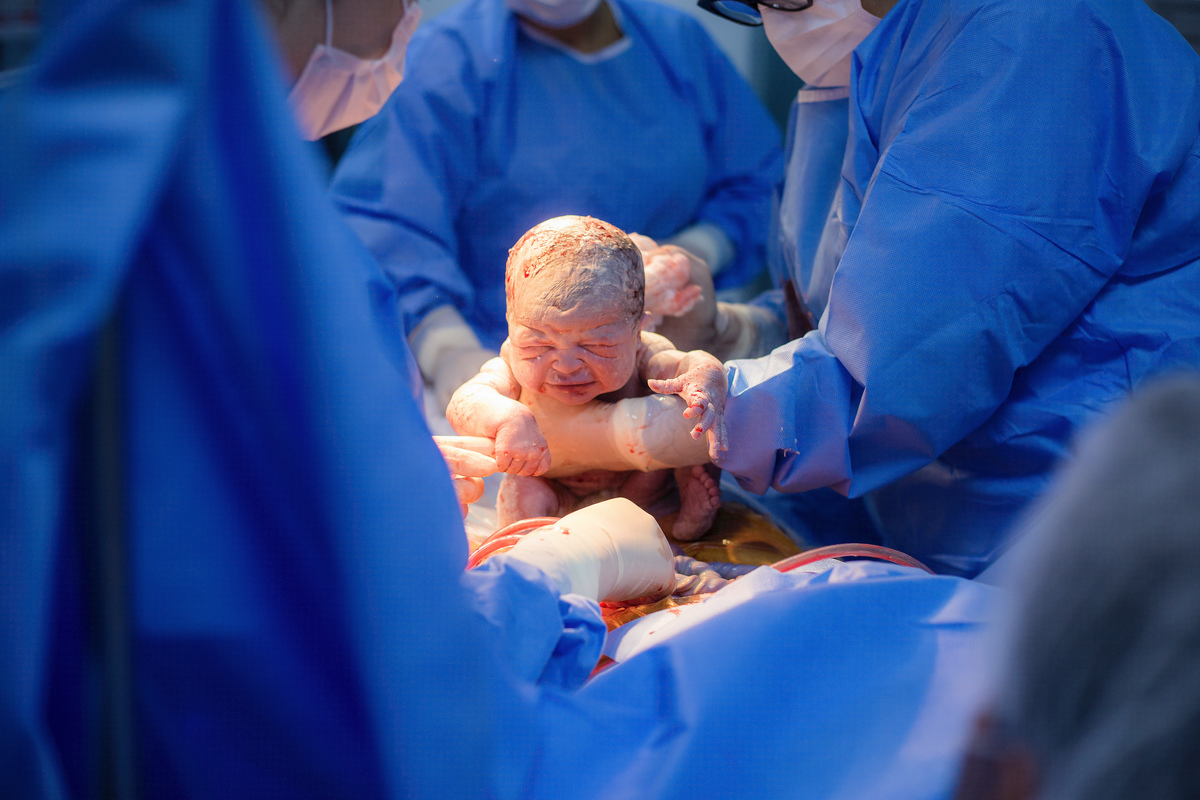 Nascimento, parto, cesariana, hospital, neném, semanas.