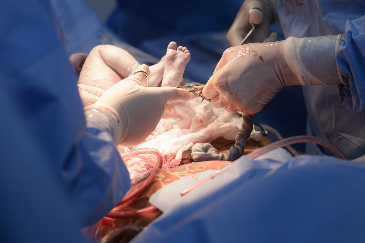 Nascimento, parto, cesariana, hospital, neném, semanas.