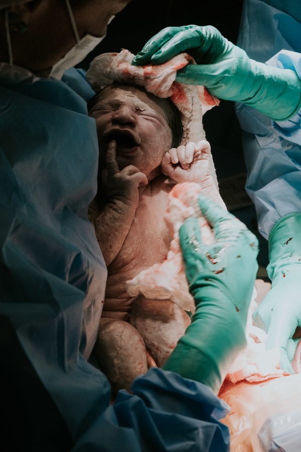 Fotografia de parto da Liz no Hospital Israelita Albert Einstein por Anderson Crepaldi Fotografia