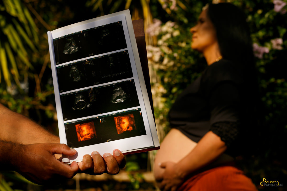 foto com ultrassom em itamarandiba mg foto criativa por duarth fernandes fotografia