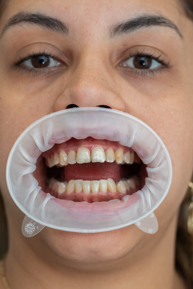 Paciente em preparação