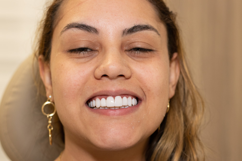 Dentista mostrando resultado final