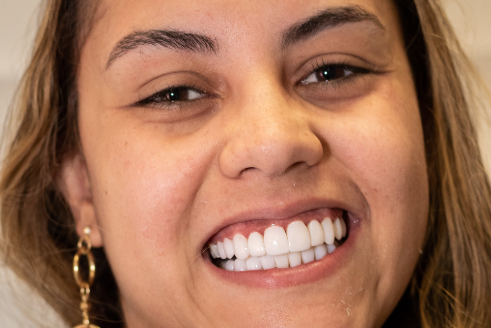 Dentista mostra resultado final do tratamento dentário