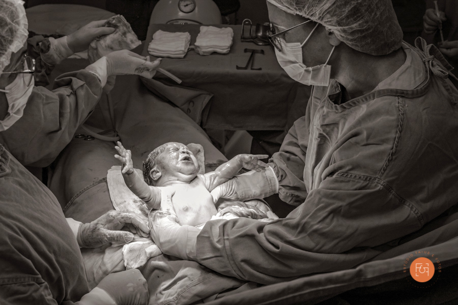 bebe nascendo cesaria