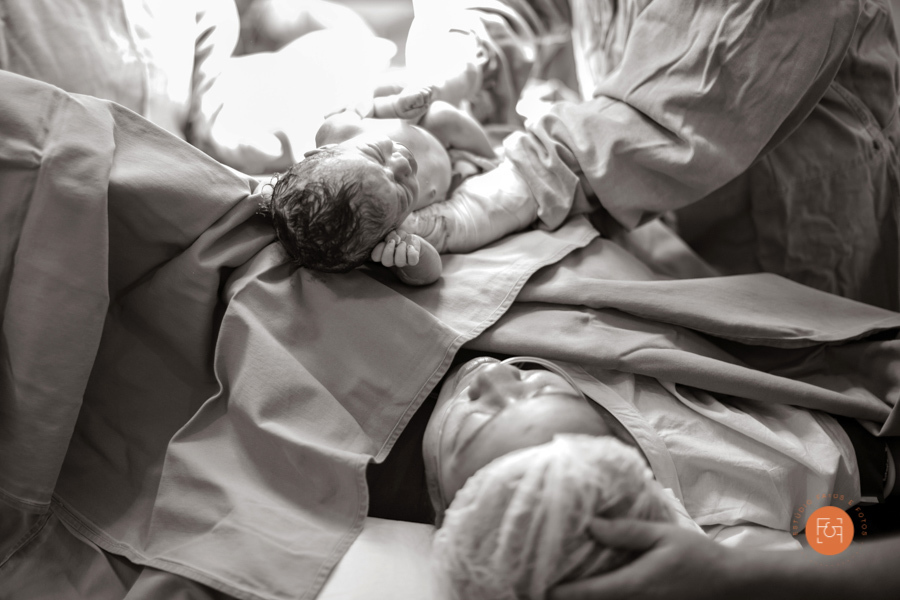 bebe nascendo cesaria