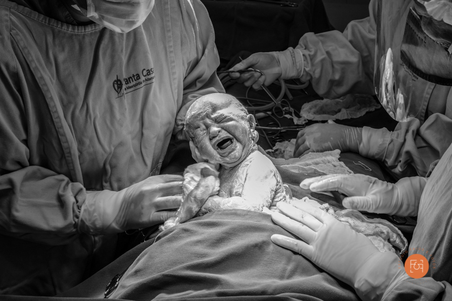 bebe nascendo cesárea