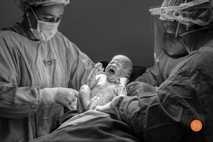 bebe nascendo cesárea