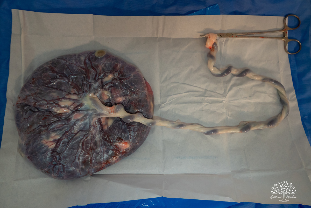 Fotografia de família - Fotografia de parto - Fotografia profissional - Chá revelação – Foto do Nascimento - Antonio Rocha Fotografias – HU – Maternidade - Ensaio fotográfico - Fotografia documental - Fotografia afetiva - Fotografia de bebês - Pelotas