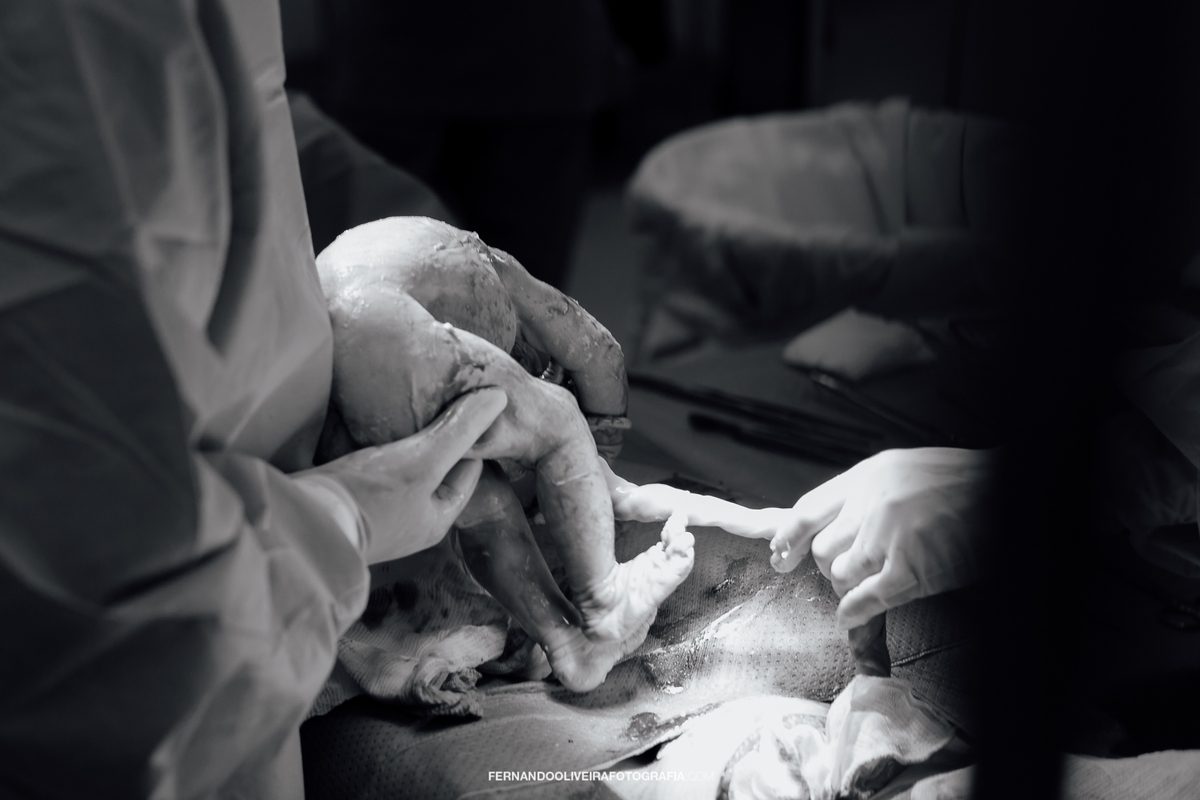 Fotografia de parto sao paulo hospital maternidade pro matre sao luiz nascimento hospital adventista