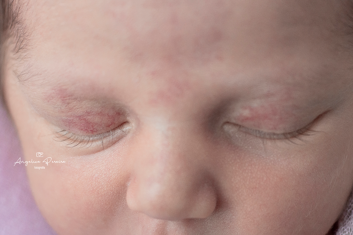 Fotografia - newborn - recém-nascido -menina - close-up - olhos
