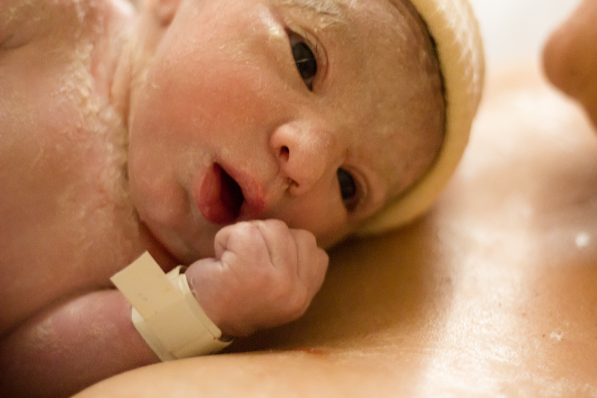 vernix bebe; parto humanizado