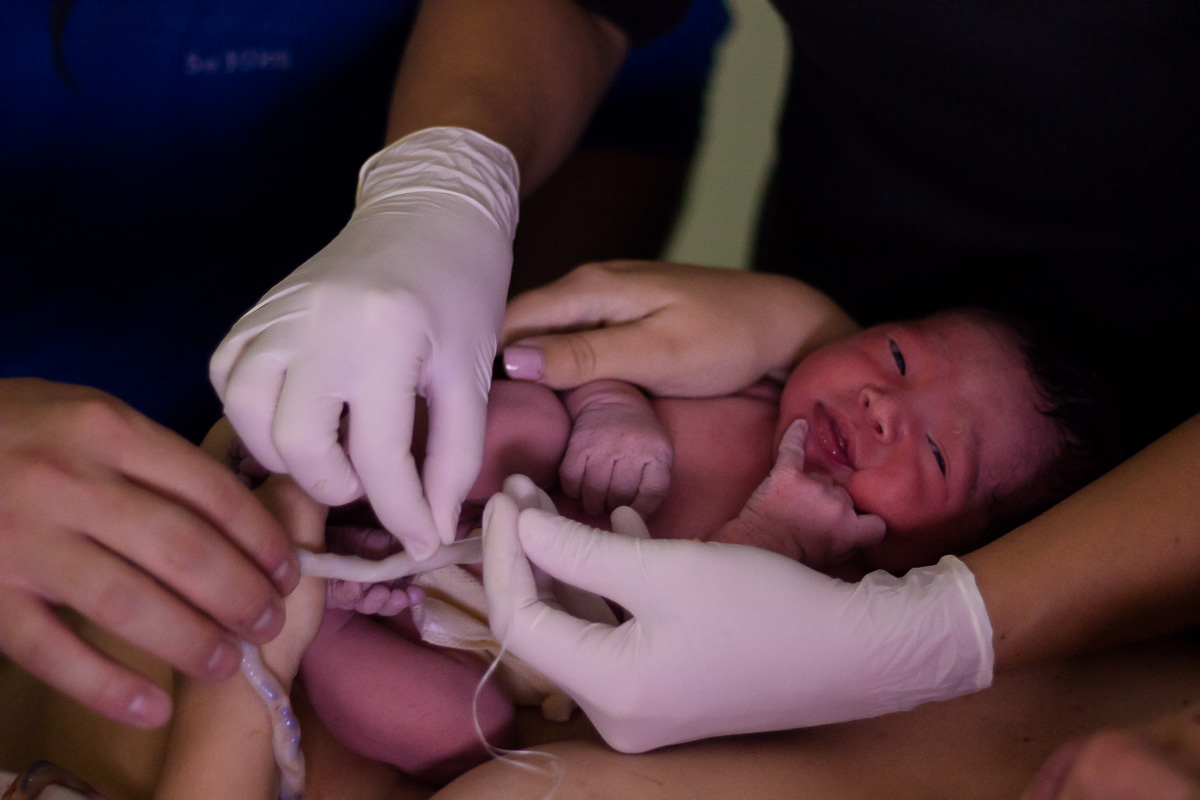cortar cordão umbilical
