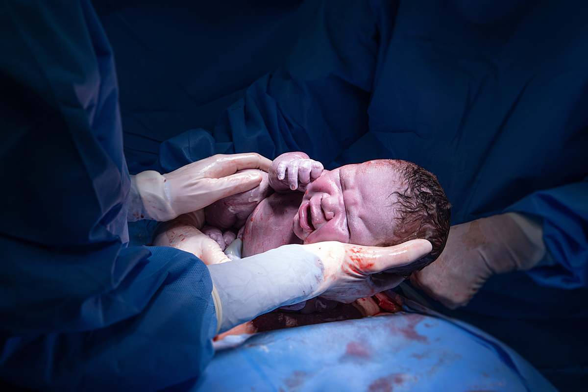 fotografia de nascimento, parto, cesaria, cesariana, nascimento, tania bauer fotografia, fotografia de parto, 