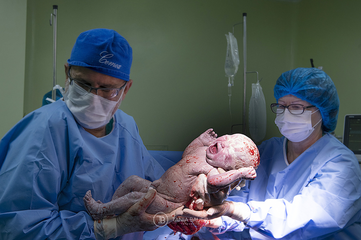 fotografia de nascimento, parto, cesaria, cesariana, nascimento, tania bauer fotografia, fotografia de parto, 